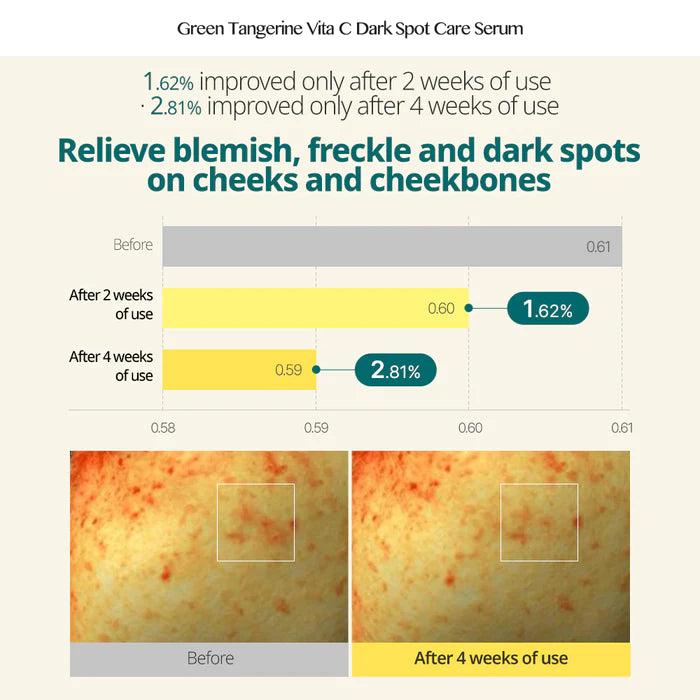 [GOODAL] Green Tangerine Vita C Dark Spot Serum 40ml